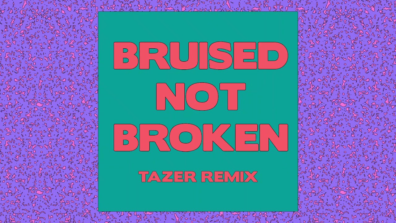 Matoma - Bruised Not Broken (feat. MNEK &amp; Kiana Ledé) [Tazer Remix] {Official Audio}