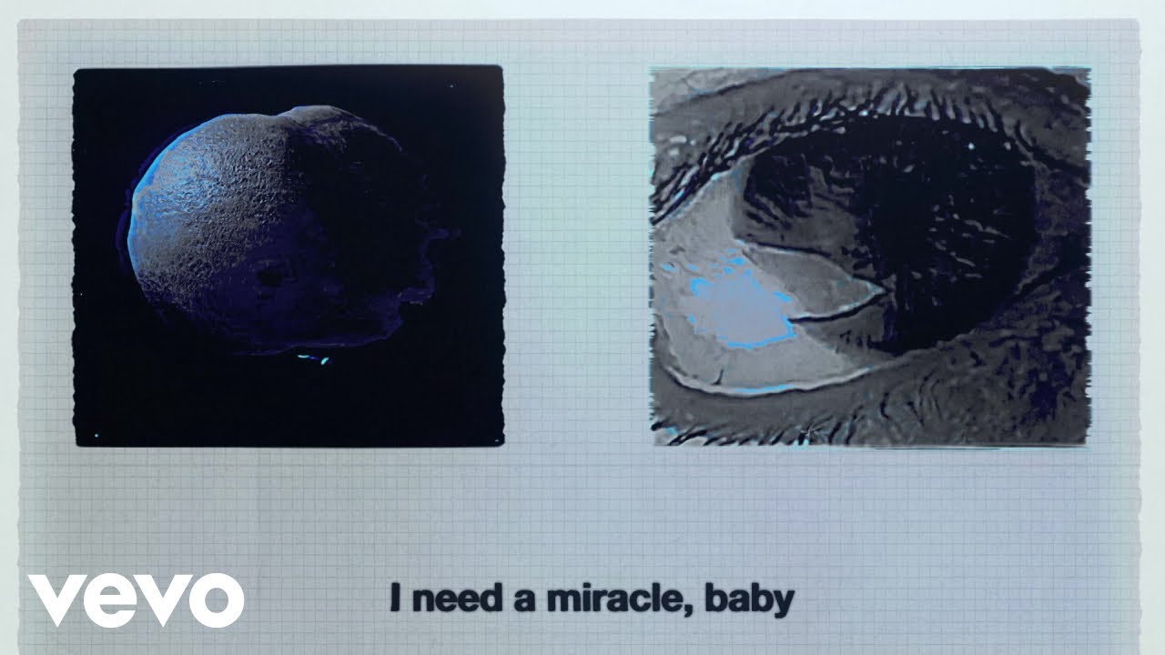 Nothing But Thieves - Miracle, Baby (Lyric Video)