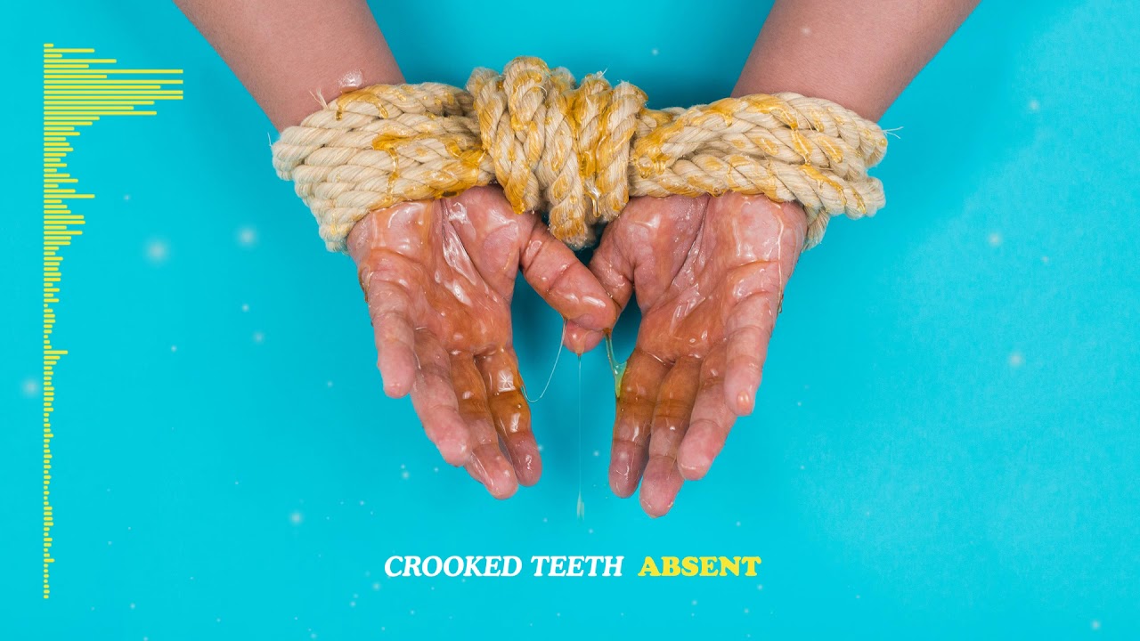 Crooked Teeth - Absent