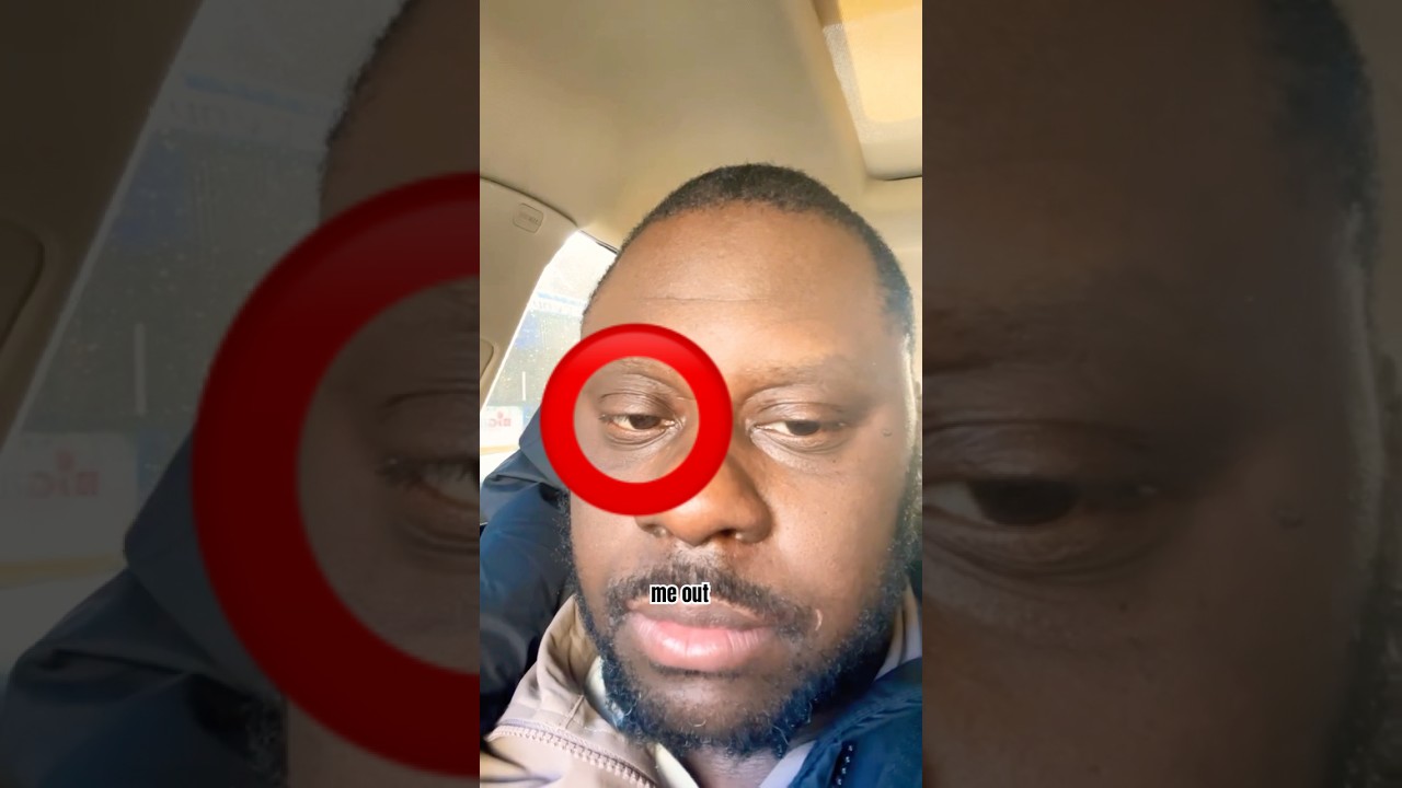 Battle Rapper T Rex says he’s having a major problem with his right eye twitching and he needs help.